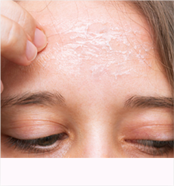 rough skin