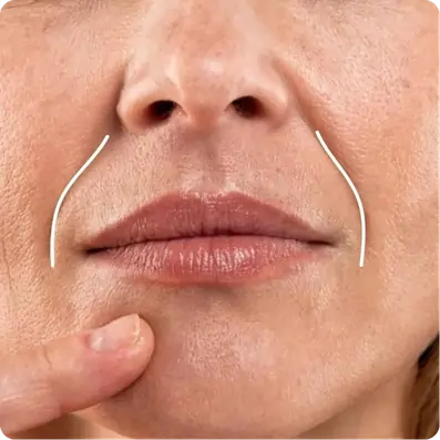 Improves Skin Elasticity & Collagen Production