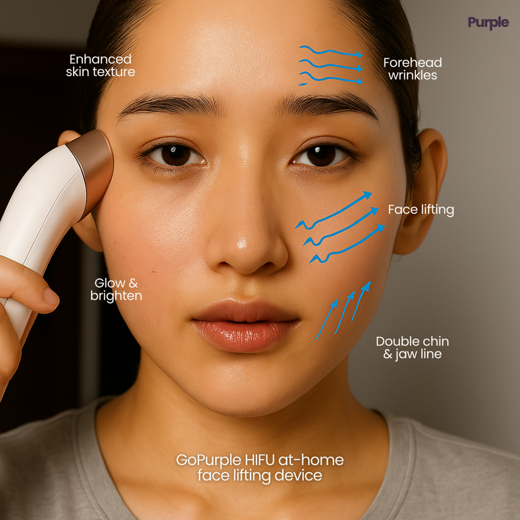 Hifu Anti Wrinkle Device