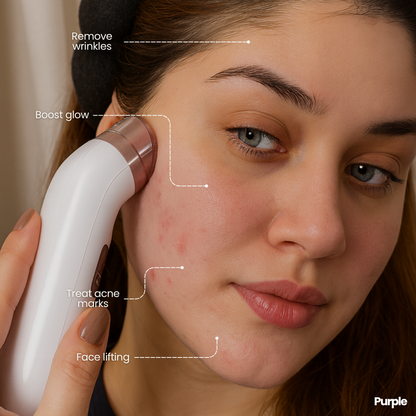 Hifu Anti Wrinkle Device