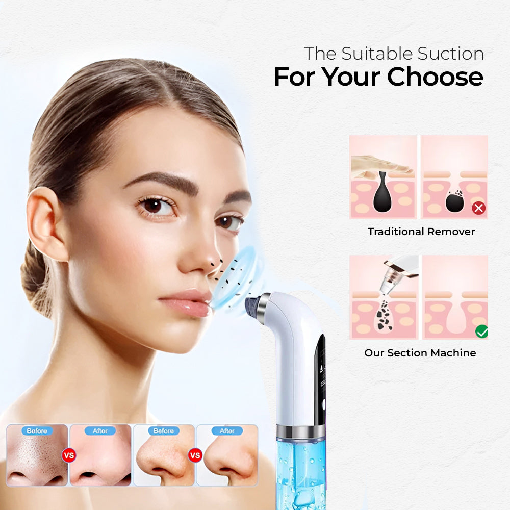 Purple Vacuum Pore Cleaner - Purple Hifu Anti Wrinkle Device & Advanced Machines in Pakistan