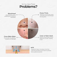 Purple Vacuum Pore Cleaner - Purple Hifu Anti Wrinkle Device & Advanced Machines in Pakistan